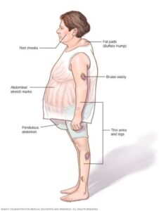 Feature-image-of-How-do-you-know-if-you-actually-have-a-cortisol-problem