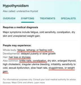 What is hypothyroidism image