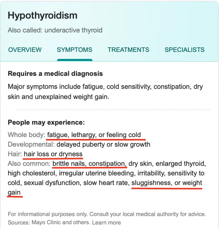 What is hypothyroidism image